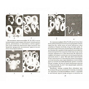 How to Cleanse Your Aura and Become Healthy. Kirlian Photography as a Help for Everyone