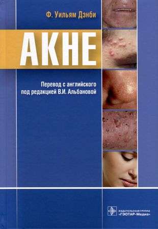 Acne