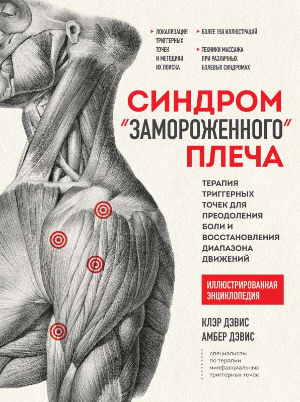 Frozen Shoulder Syndrome. Trigger Point Therapy for Overcoming Pain and Restoring Range of Motion