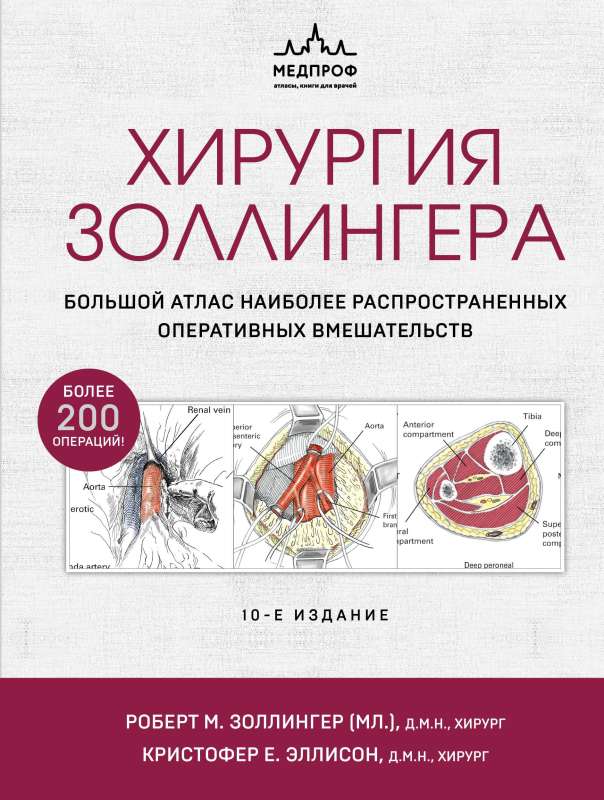 Zollinger's Surgery. A Large Atlas of the Most Common Surgical Interventions