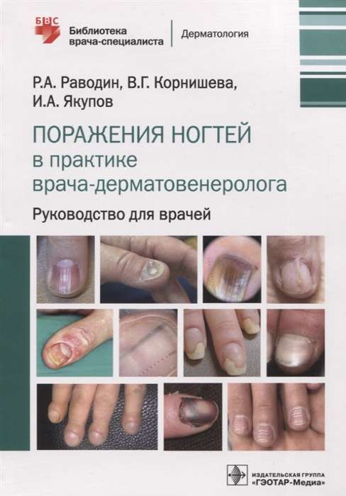 Nail Disorders in Dermatovenereology Practice. A Guide for Physicians