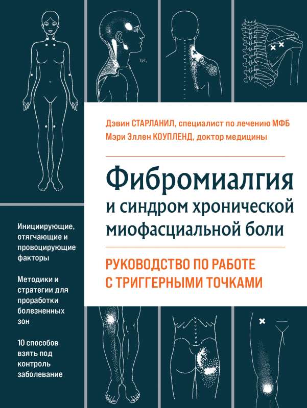 Fibromyalgia and Chronic Myofascial Pain Syndrome. A Guide to Working with Trigger Points