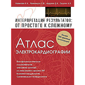 Атлас электрокардиографии. Интерпретация результатов: от простого к сложному