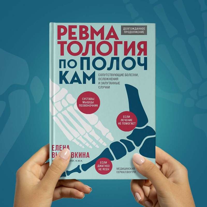 Rheumatology Explained. Comorbidities, Complications, and Complicated Cases