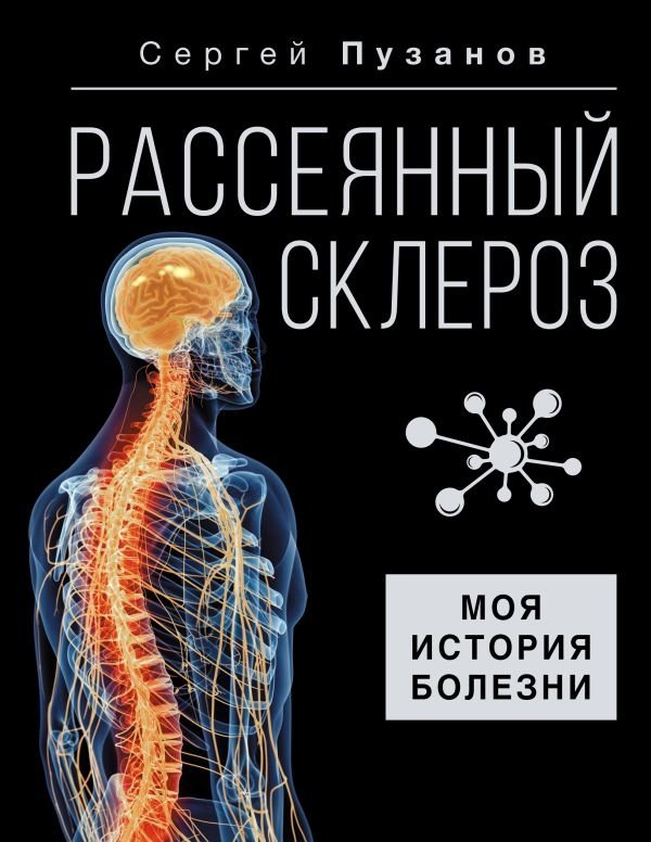 Multiple Sclerosis. My Medical History