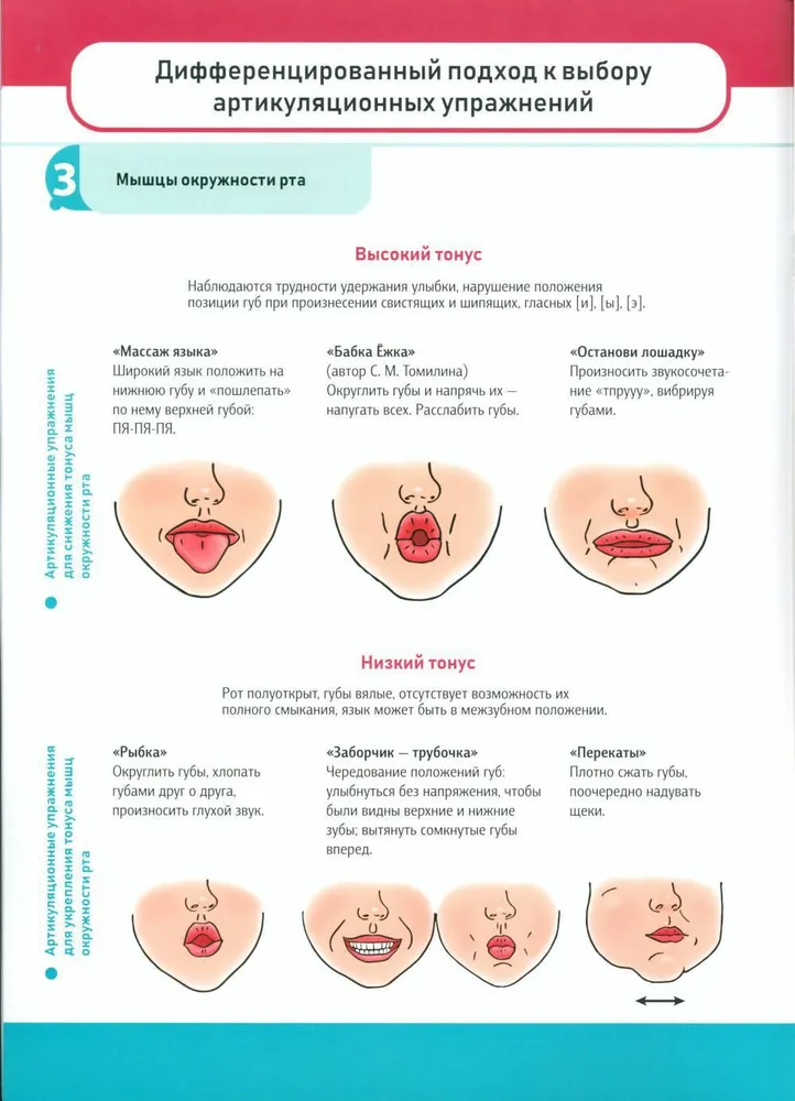 Practical Tips for Overcoming Speech Disorders in Children with Dysarthria. Speech Therapy Posters. Ages 4-8