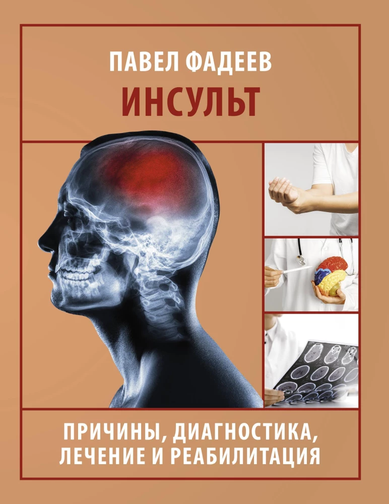 Stroke. Causes, Diagnosis, Treatment, and Rehabilitation