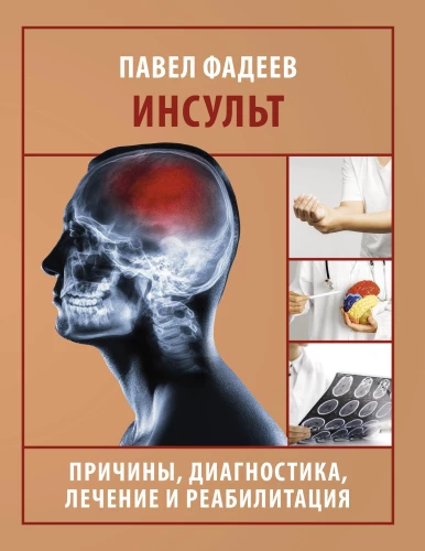 Stroke. Causes, Diagnosis, Treatment, and Rehabilitation