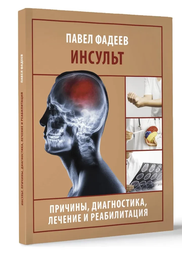 Stroke. Causes, Diagnosis, Treatment, and Rehabilitation