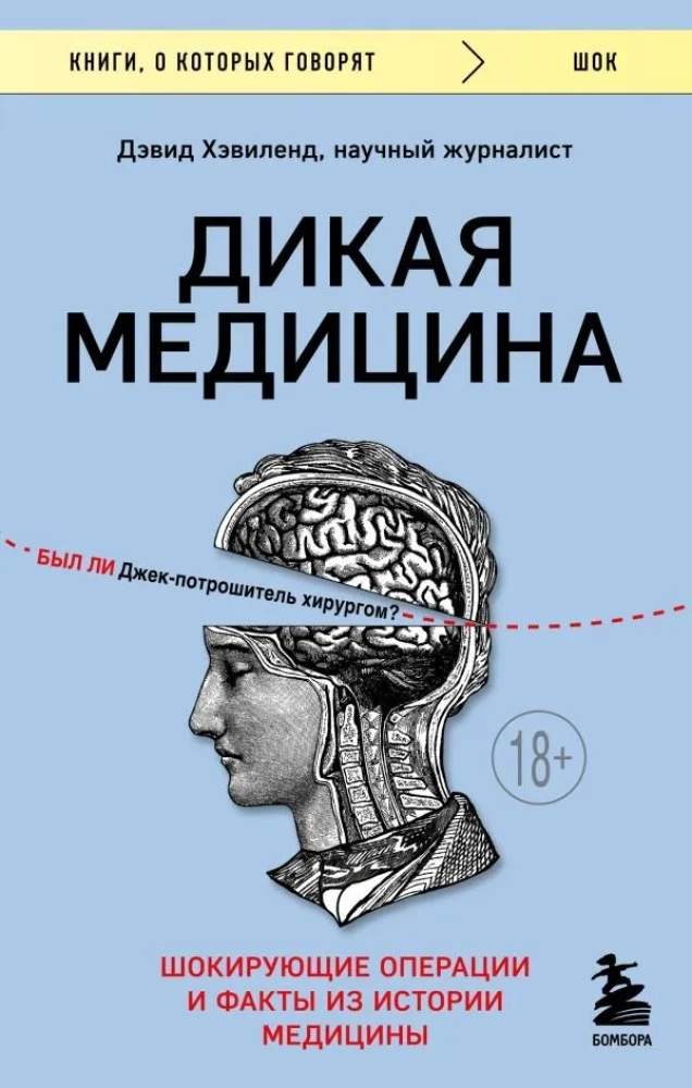 Wild Medicine. Shocking Operations and Facts from the History of Medicine