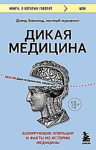 Wild Medicine. Shocking Operations and Facts from the History of Medicine