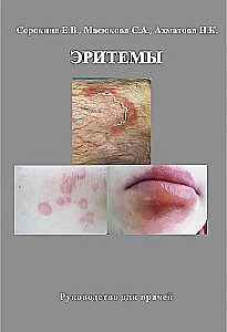 Erythemas. A Guide for Physicians