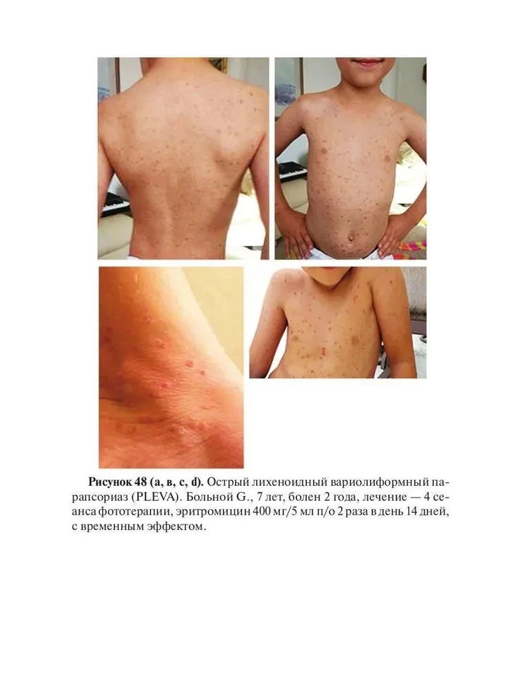Erythemas. A Guide for Physicians