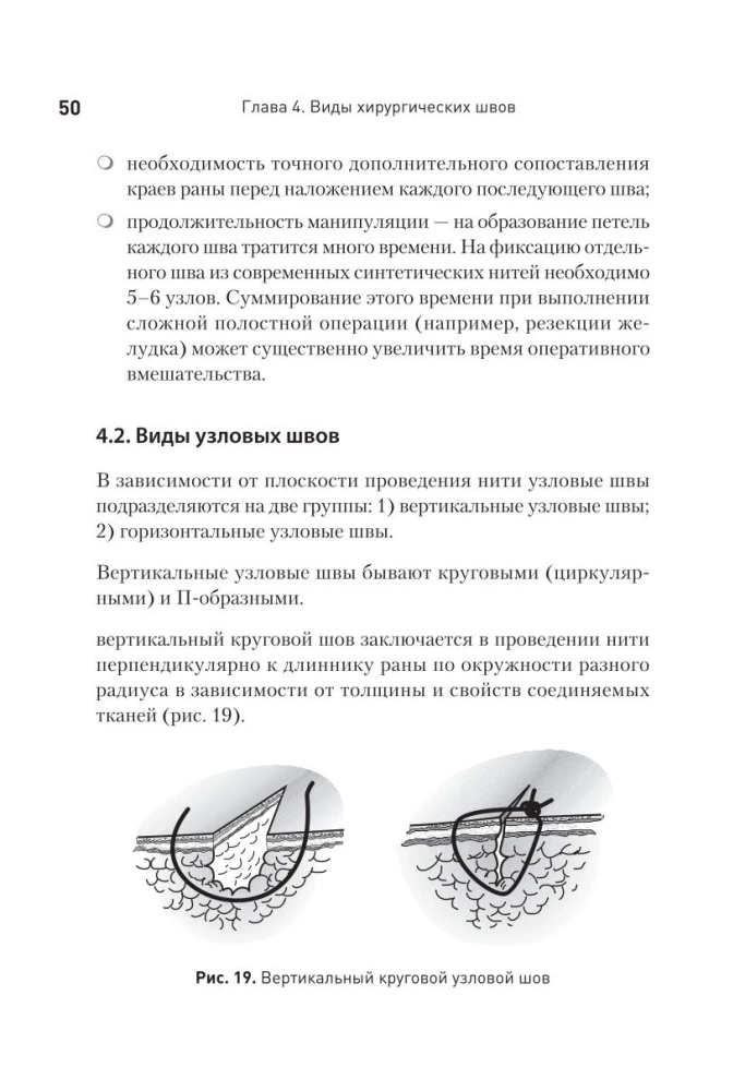 Szew chirurgiczny