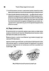 Szew chirurgiczny