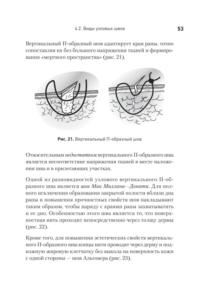 Szew chirurgiczny