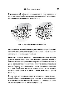 Szew chirurgiczny