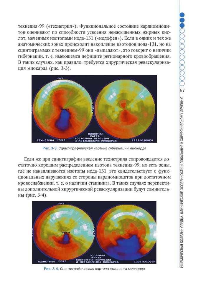 Kliniczne aspekty chirurgii sercowo-naczyniowej