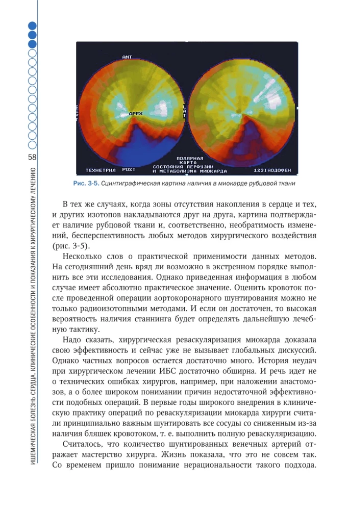 Kliniczne aspekty chirurgii sercowo-naczyniowej