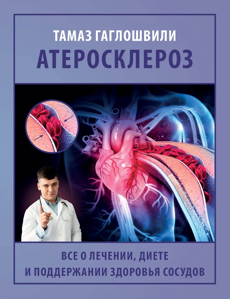 Ateroskleroze. Viss par ārstēšanu, diētu un asinsvadu veselības uzturēšanu