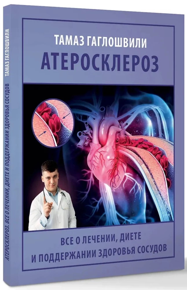 Атеросклероз. Все о лечении, диете и поддержании здоровья сосудов