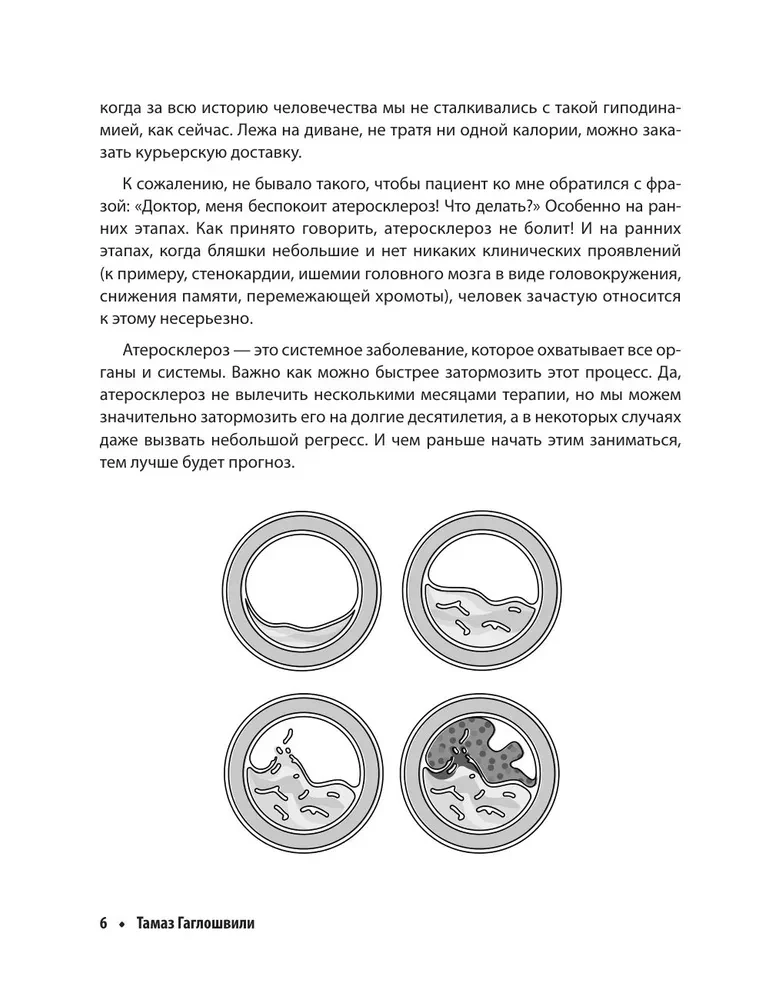 Атеросклероз. Все о лечении, диете и поддержании здоровья сосудов