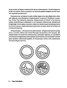 Атеросклероз. Все о лечении, диете и поддержании здоровья сосудов