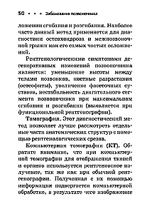 Choroby kręgosłupa. Kieszonkowy poradnik