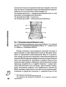 Язвенная болезнь. Факторы риска, симптомы, лечение и диета